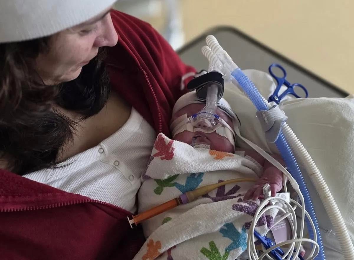 Alice, fighting a severe congenital heart defect